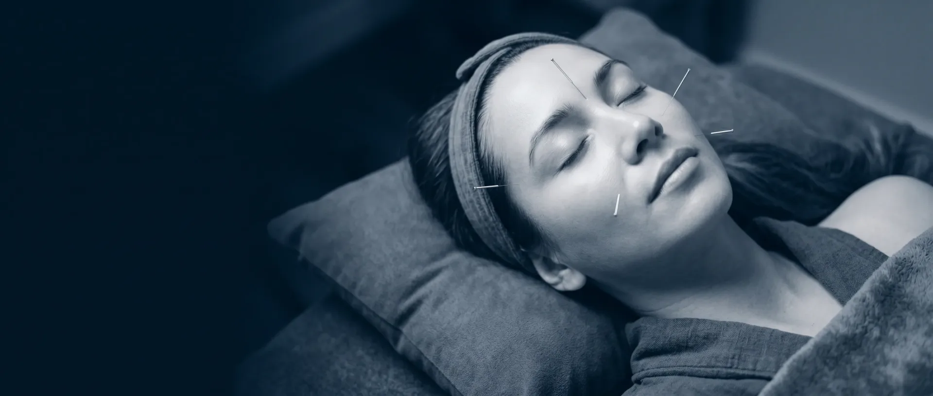 Facial acupuncture NYC