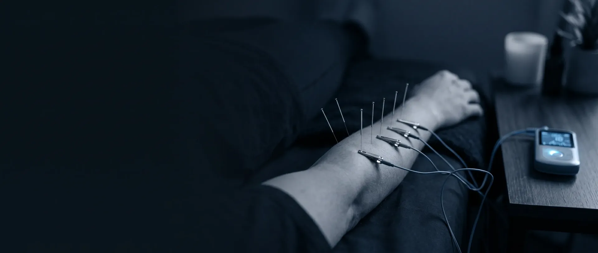 Electro-acupuncture Downtown Manhattan